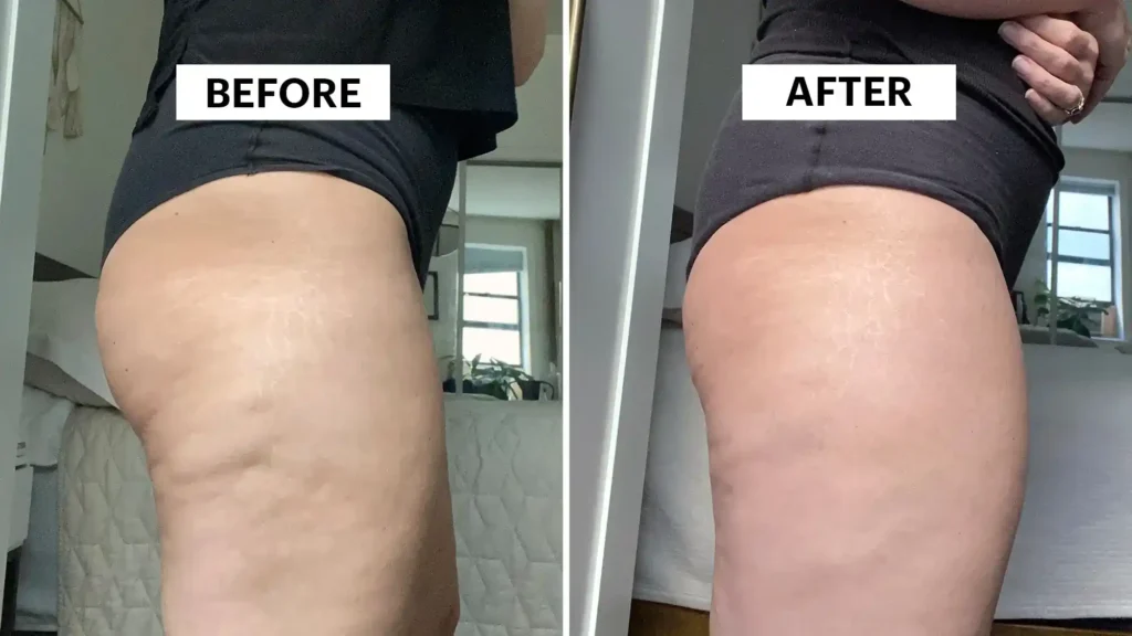 Do Toning Exercise Leigh-on-Sea Really Tackle Cellulite?